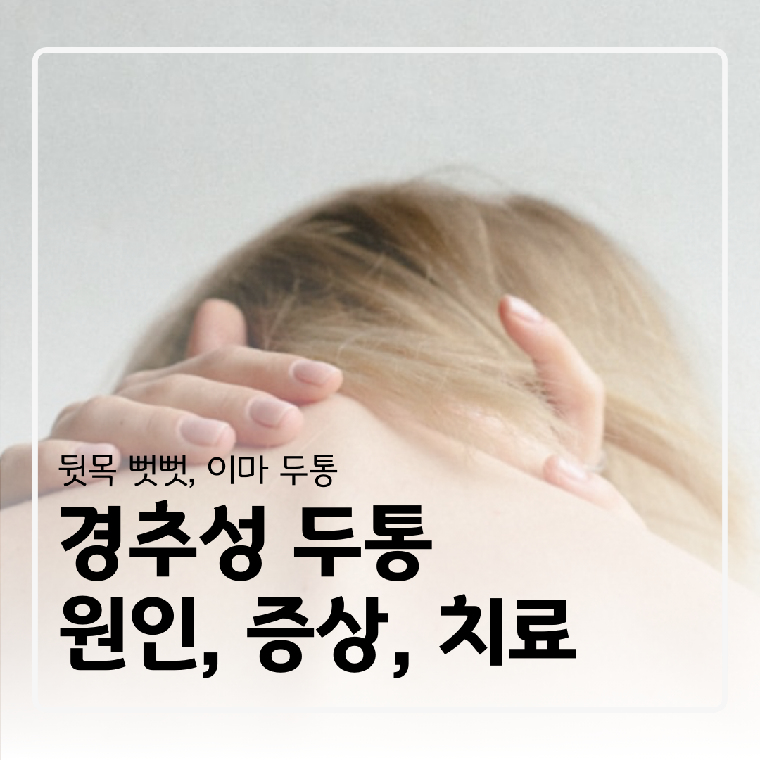 경추성 두통, 이마 두통, 거북목, 일자목, 목 뻣뻣