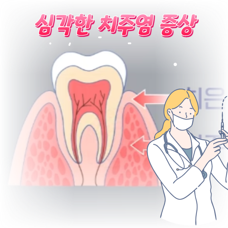  이런 치주염 증상이 있다면 꼭 병원으로 가세요