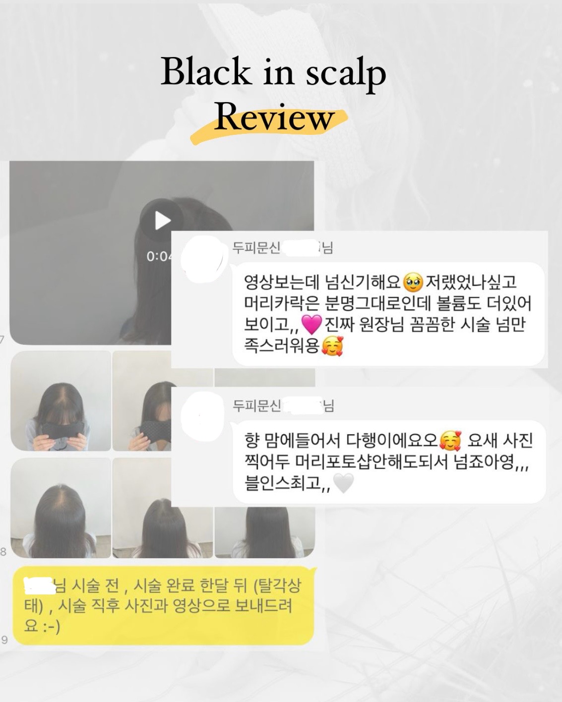 도트인스칼프 이미지