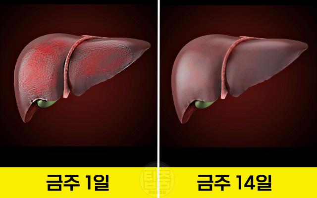 술 끊기 한달 술 끊으면 변화 간 회복