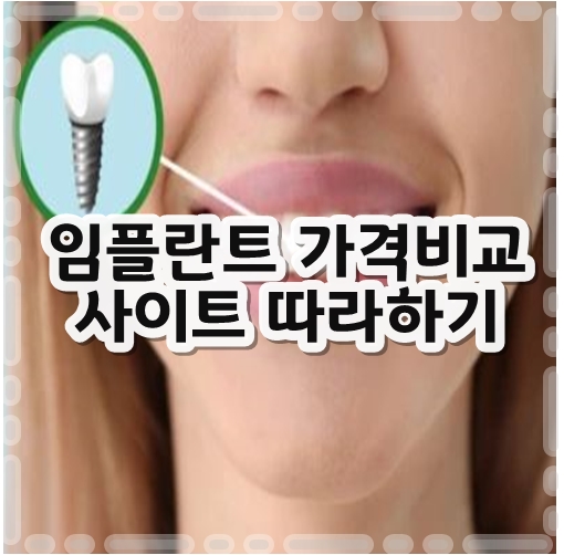 임플란트가격비교사이트따라하기