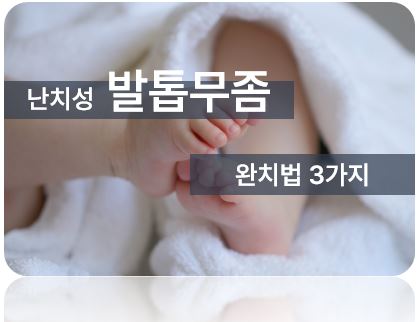 발톱무좀