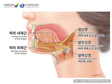 설암 초기증상