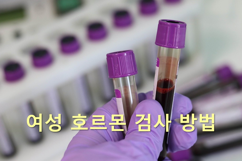  에스트로겐과 프로게스테론 여성 호르몬 검사 방법