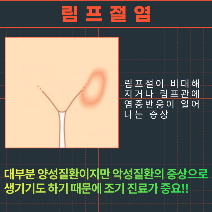 림프절염-원인
