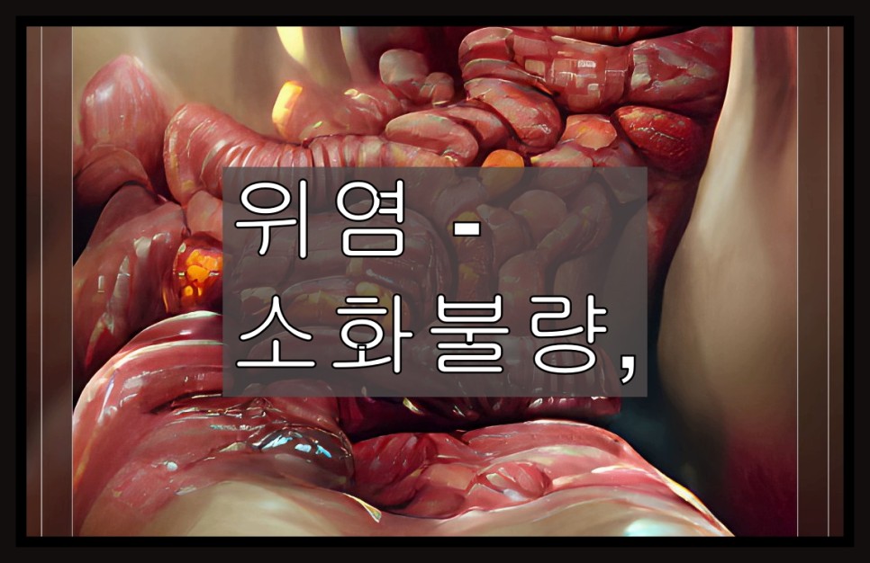 위염 위궤양에 좋은 음식 위염 - 소화불량, 팽만감 및 기타