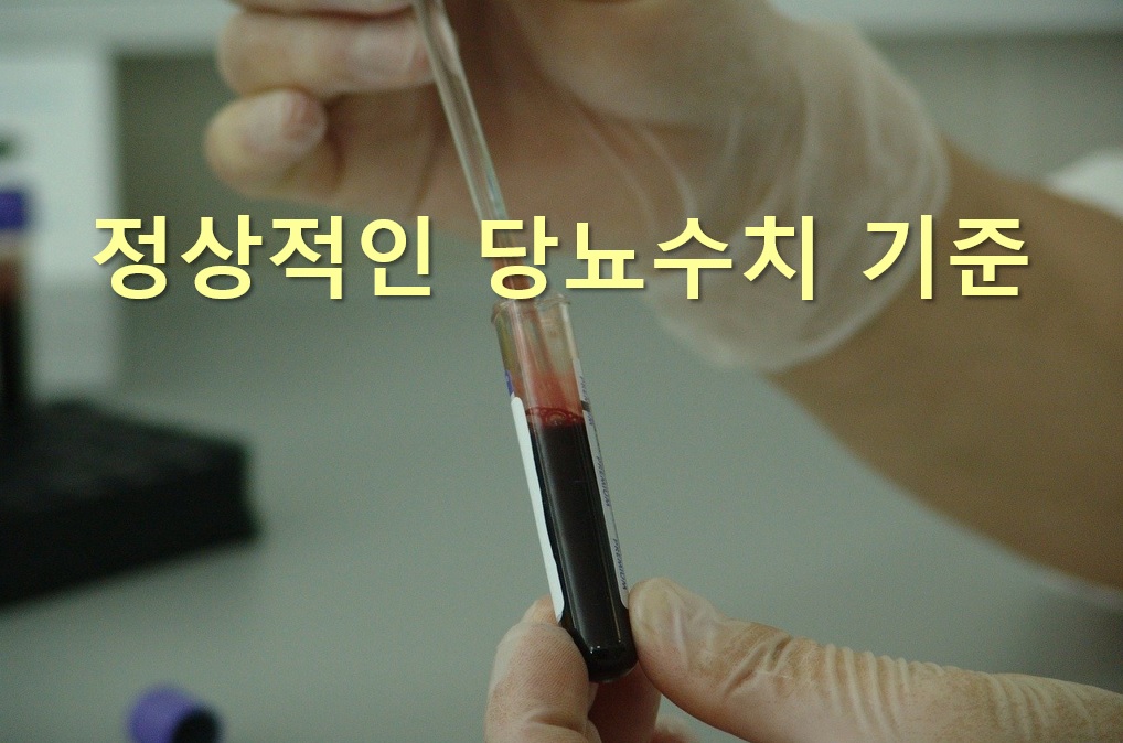  당뇨병 증상과 정상적인 당뇨 수치 기준