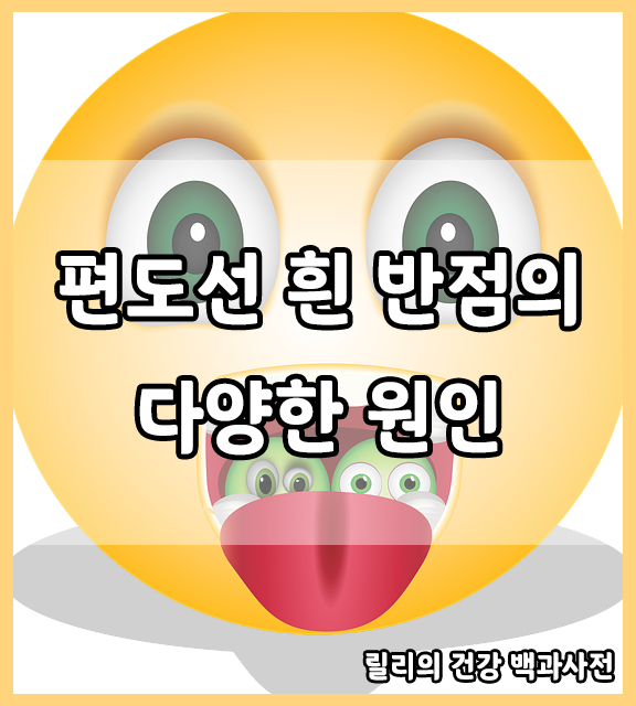  편도선 : 편도선에 흰 반점, 편도선염, 감염성 단핵구증, 패혈성 인두염, 편도결석, 코로나 편도선