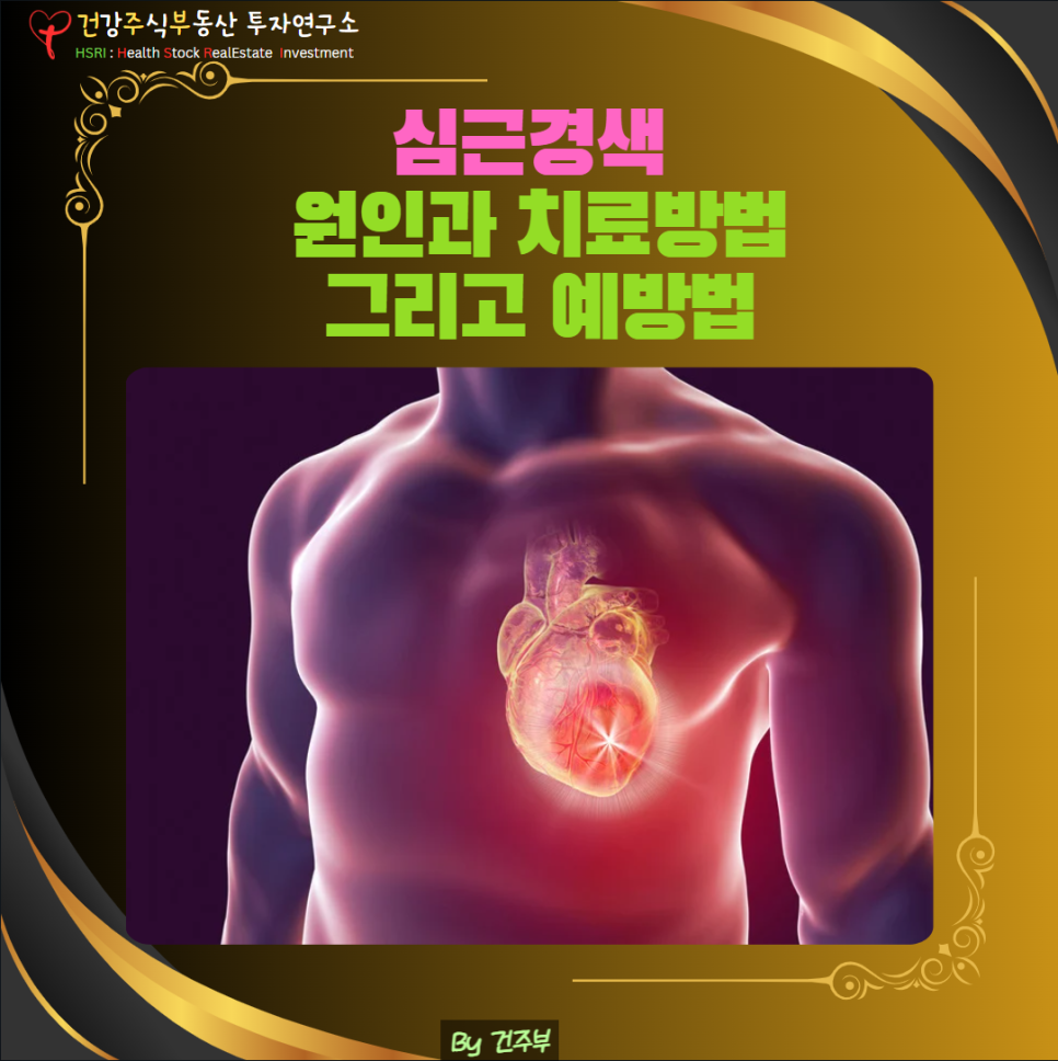 심근경색 원인과 치료방법
(글 그림 : 건주부, 그림 출처 : Canva)
