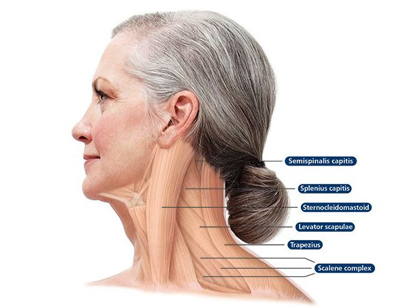  이봉주 근육 긴장 이상증(dystonia) 무도병 등근육 통증 원인 치료방법