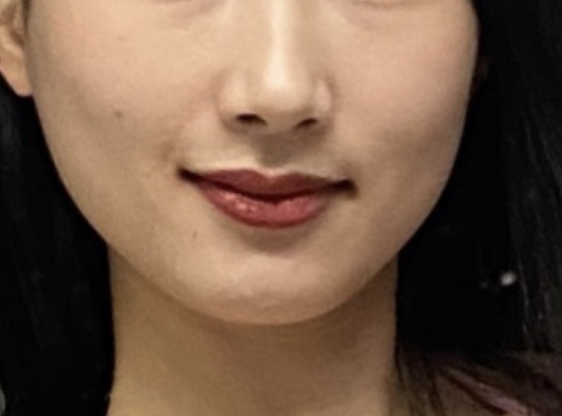 작은얼굴에스테틱 이미지