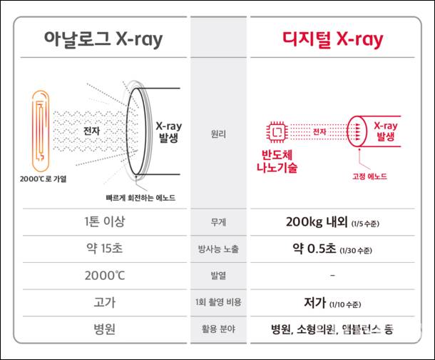 디지털 x-ray