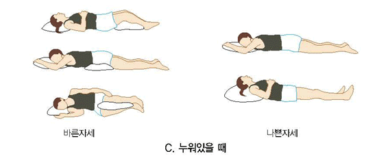 허리디스크 증세