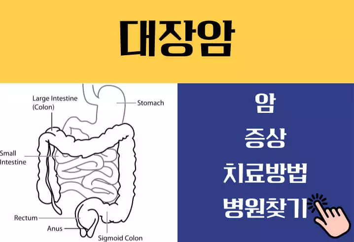 대장암 초기증상 바로알기