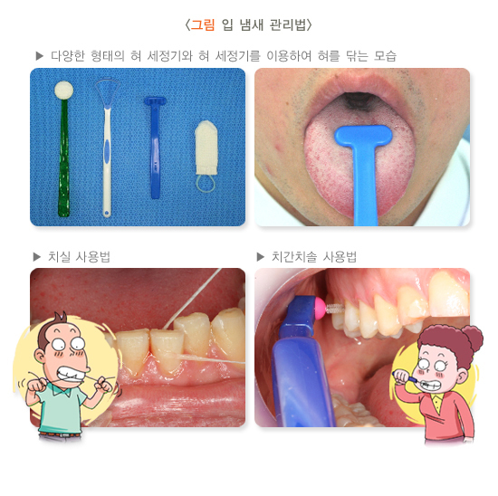  구취 원인과 치료방법