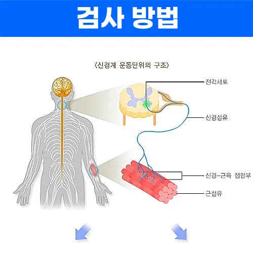 근전도 검사 방법