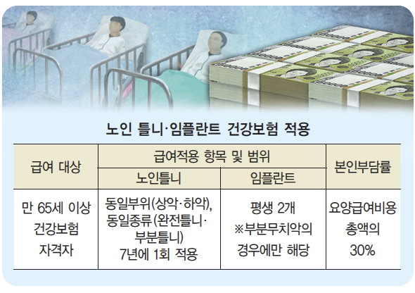  "어금니 임플란트 비용과 의료보험의 차이점"