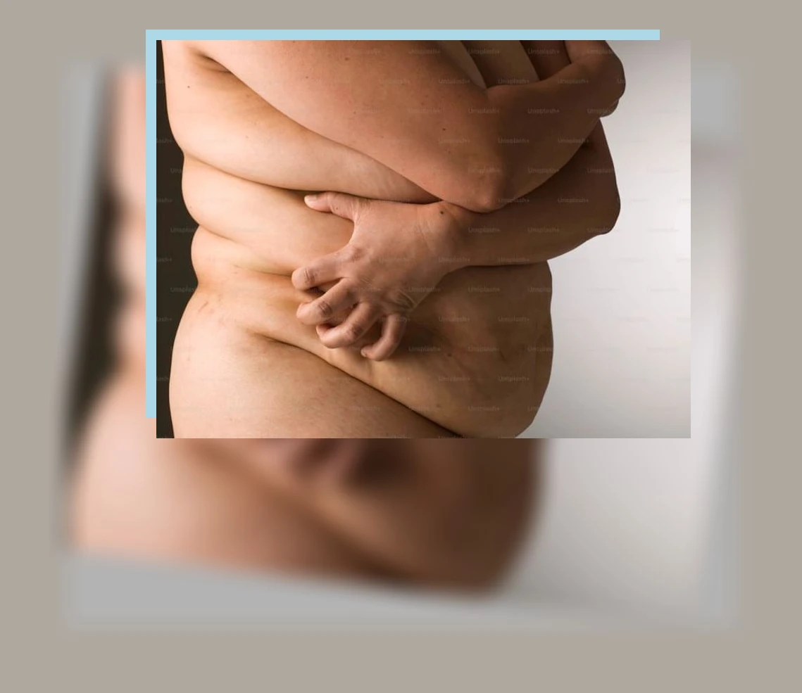 대사증후군 관리_1_subsection