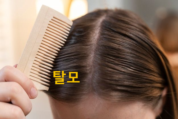  탈모 예방에 좋은 6가지 음식 과 습관