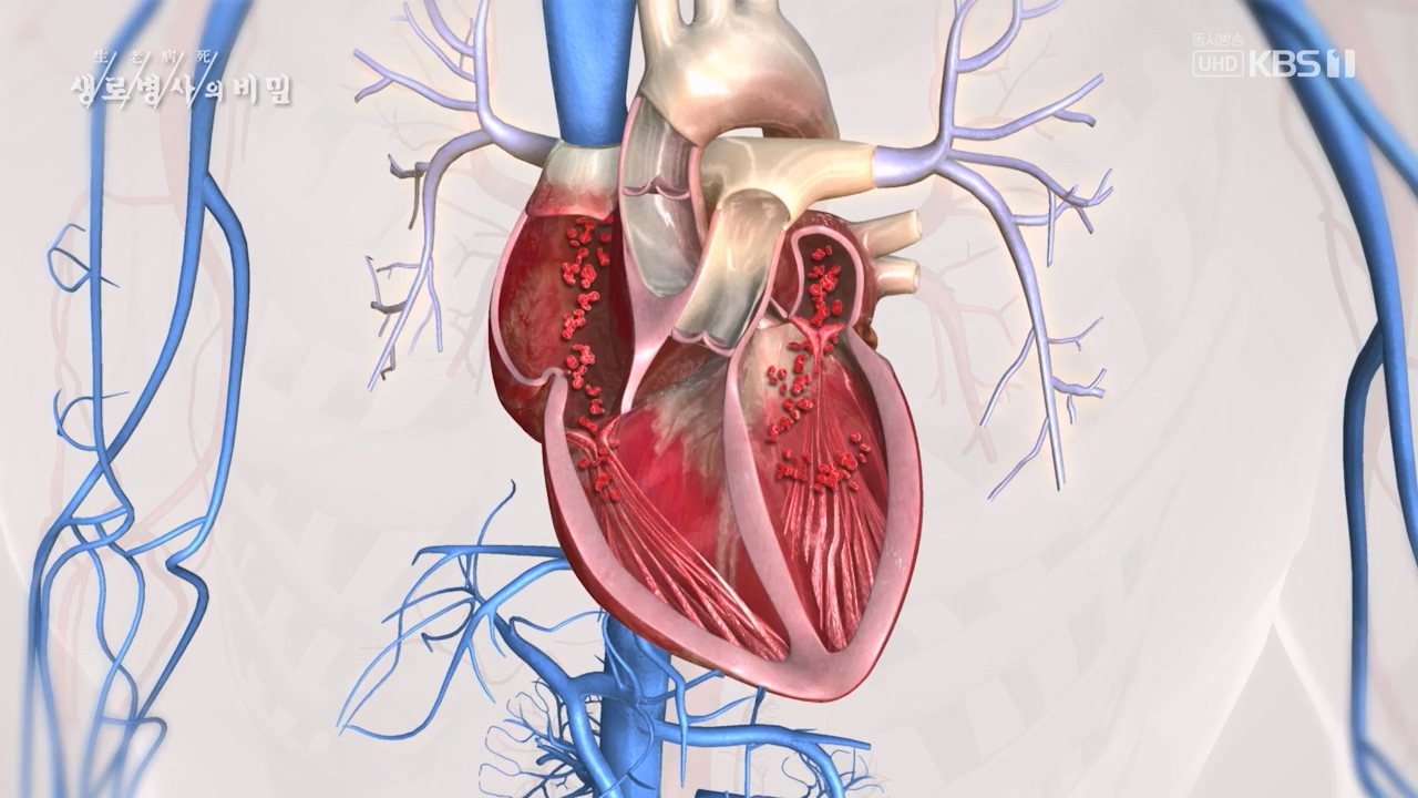 생로병사의 비밀.E900.240215p-NEXT.mp4_20240215_202857.133.jpg