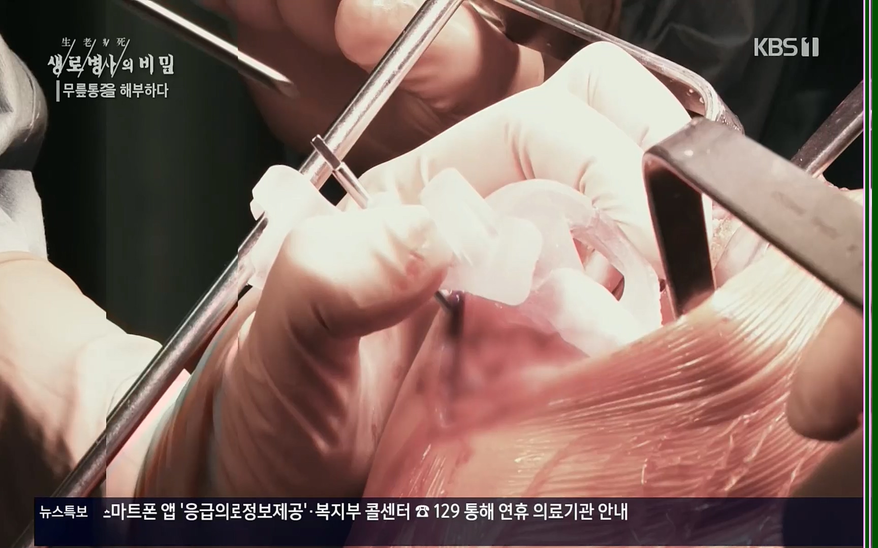 생로병사의 비밀.E834.220907p.H264-F1RST.mp4_20220908_210419.294.jpg