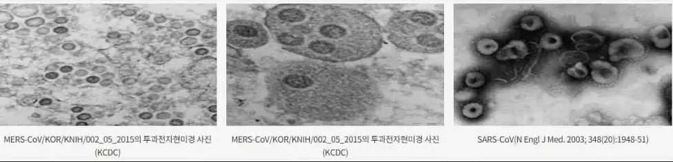 메르스&#44; 사스 전자현미경 /사진 출처 : 보건복지부