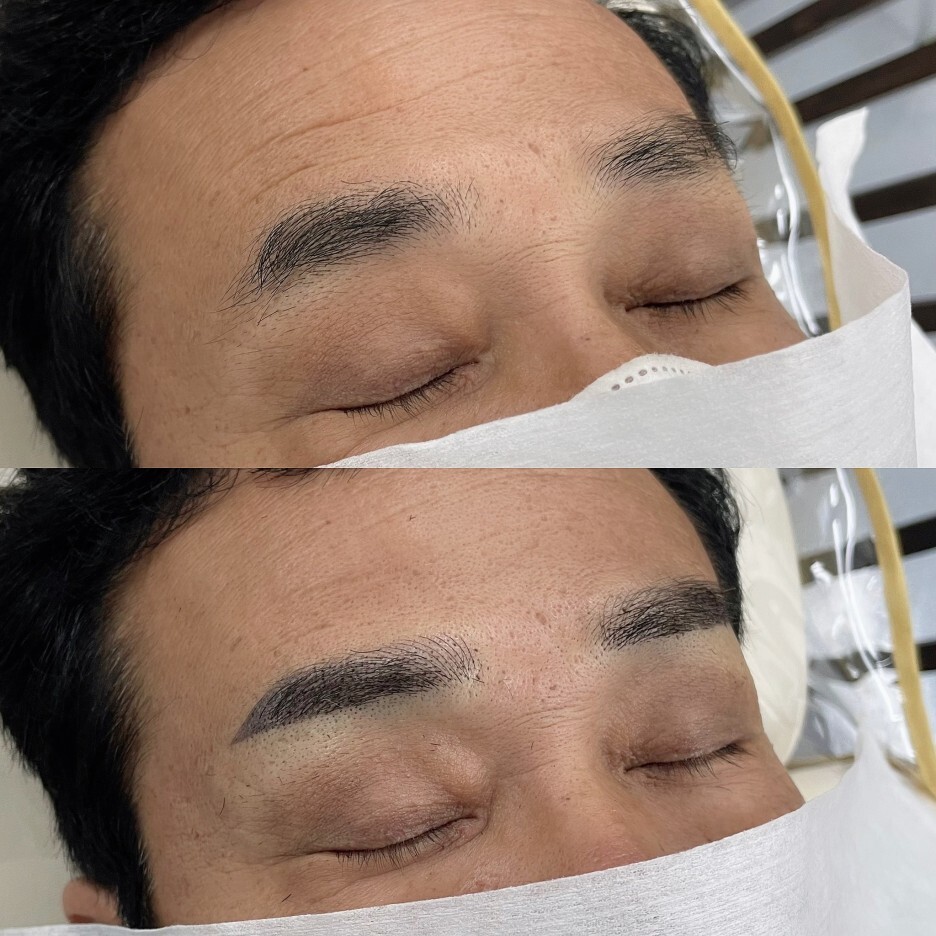  천안눈썹문신, 붉은눈썹 잔흔커버는 여기