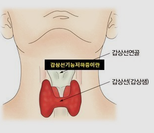  갑상선 그게 뭐였드라~