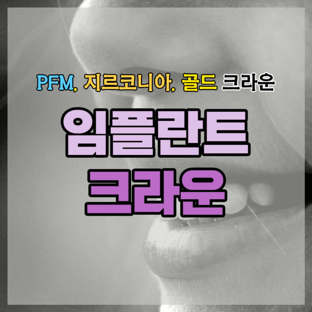 임플란트 크라운 썸네일