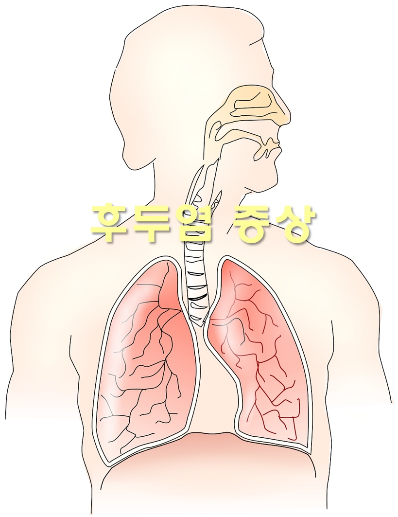  후두염 증상과 후두염에 좋은 음식
