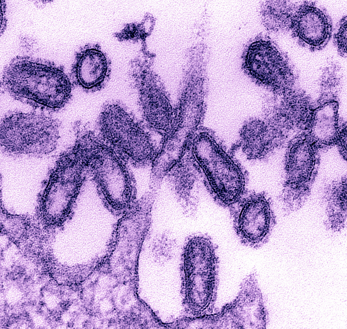스페인 독감 바이러스 현미경 사진