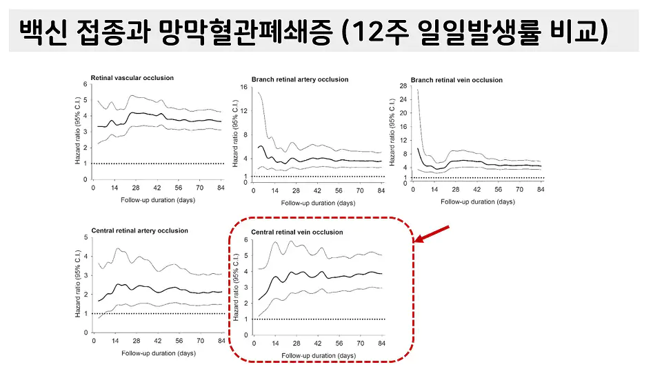 망막혈관폐쇄증 코로나 백신 부작용 논문&#44; 이덕희 경북의대 교수