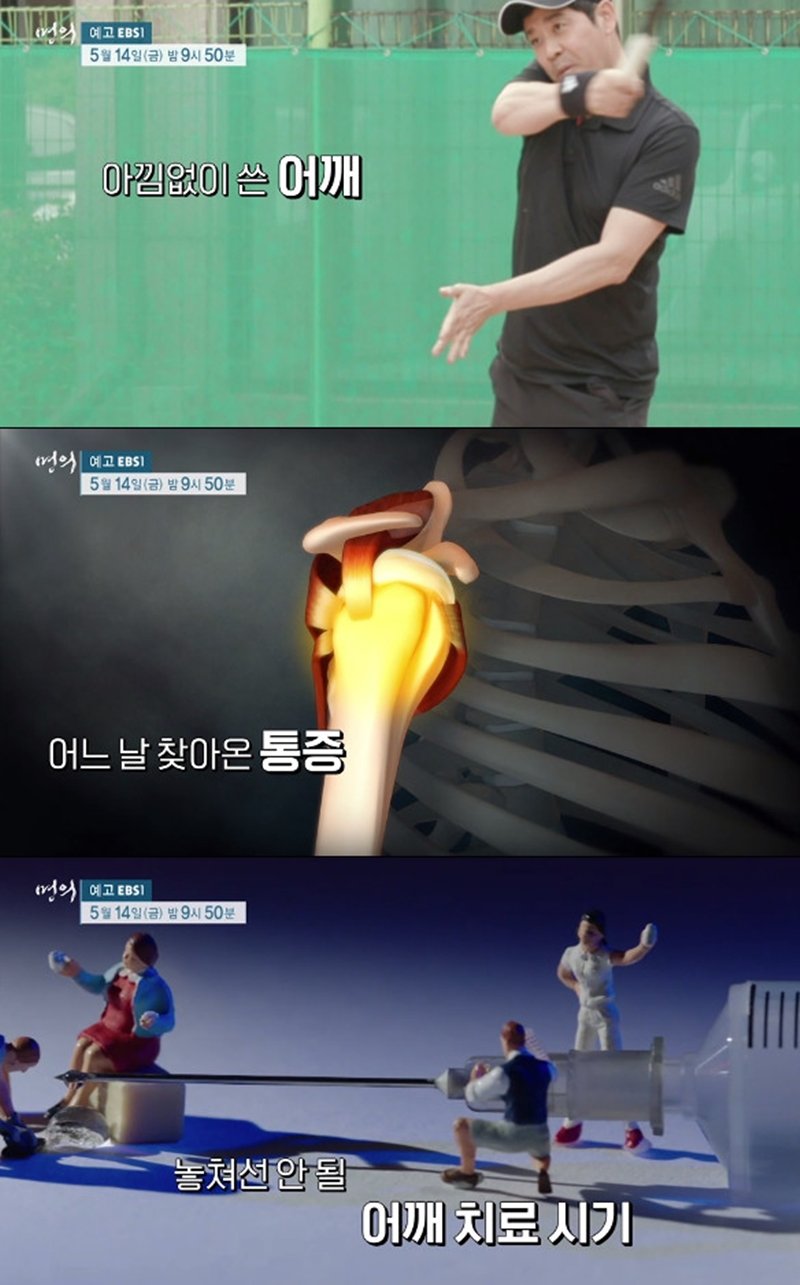  '명의' 어깨 통증, 부분 파열 방치시 악화…원인 및 치료 시기는?