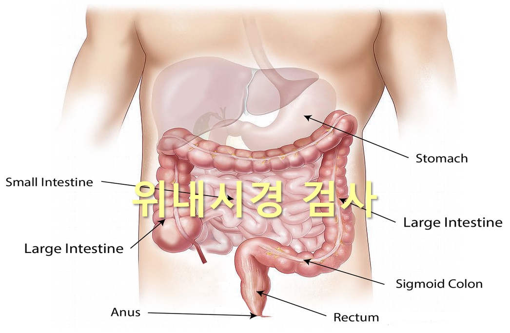  위장질환을 진단하는 위내시경 검사와 위내시경 조직검사