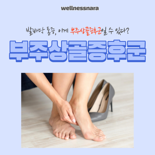 발바닥 안쪽 통증, '부주상골증후군'일 수 있습니다.