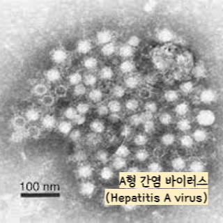 식중독-증상