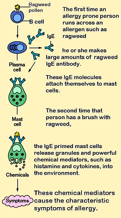항원 항체 반응으로 히스타민 방출과 알레르기 증상 발생 과정