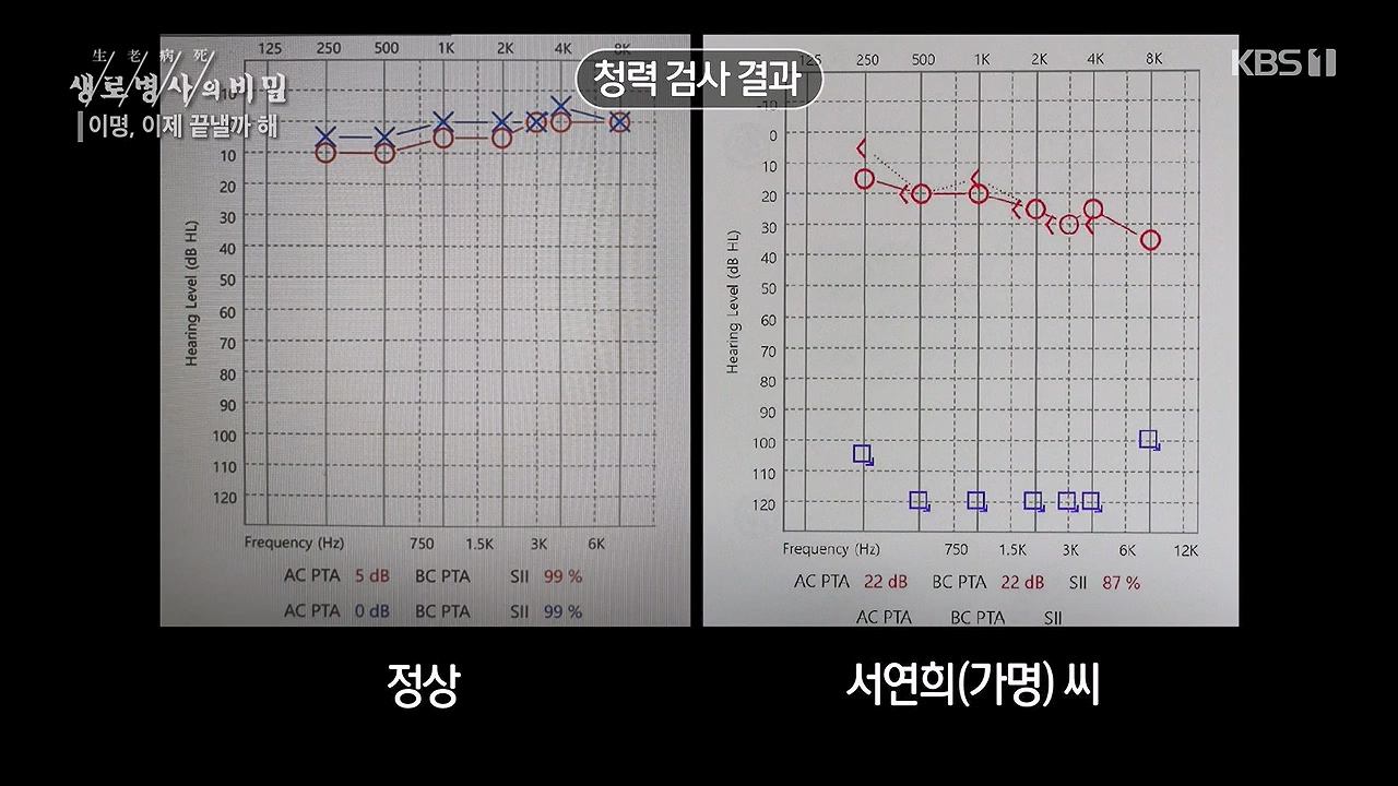 생로병사의 비밀.E883.230914p-NEXT.mp4_20230914_204616.085.jpg