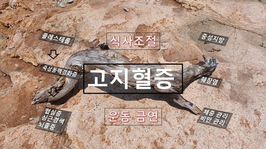 고지혈증