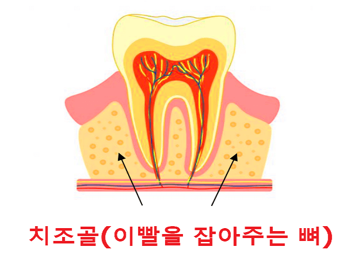 치조골 사진