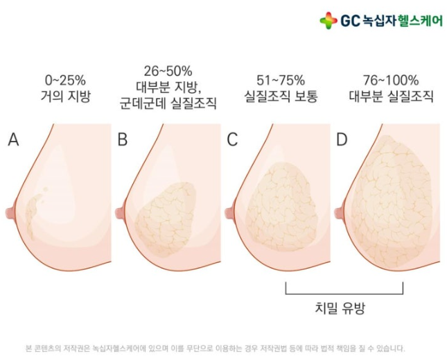 편평유두 치밀유방도 모유수유 직수완모 ★할 뚜 이 따!!!★ - 2명 2년 완모 성공 후기