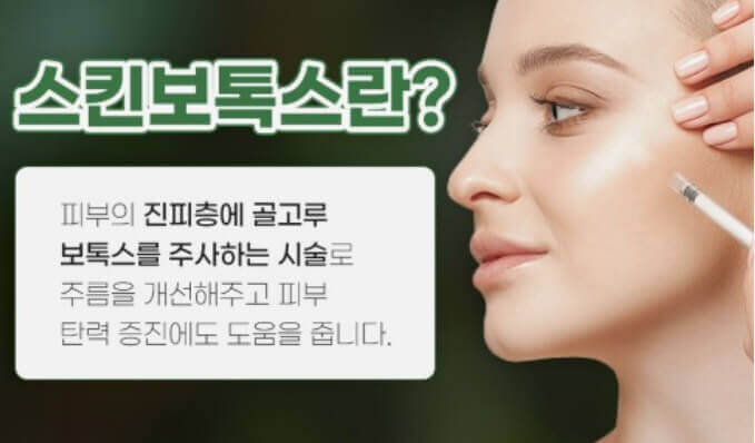  보톡스 맞아야 할 곳, 맞지 말아야 할 곳 부작용과 단점