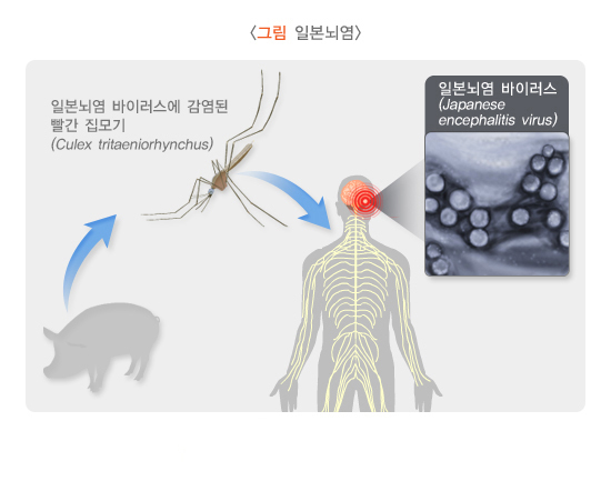  일본뇌염