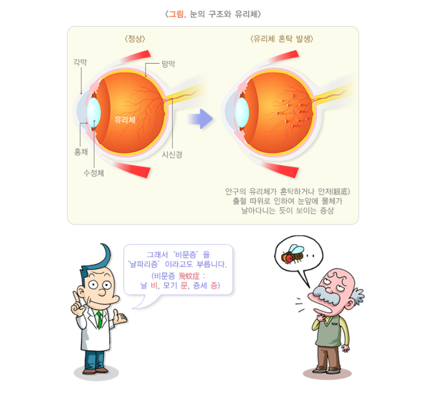 눈의 구조와 유리체