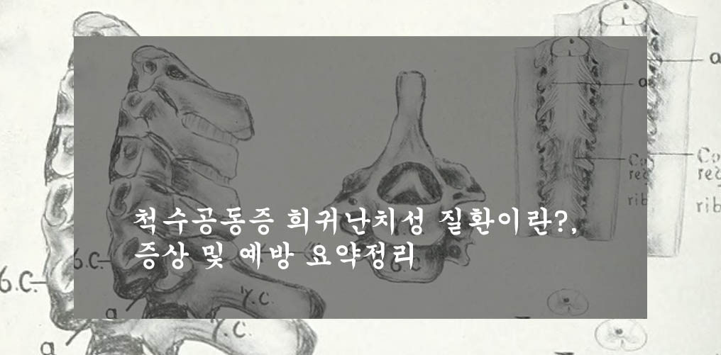  척수공동증 희귀난치성 질환이란?, 증상 및 예방 요약정리