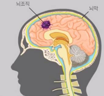 뇌 구조와 인간 행동의 관련성에 대해 예시를 들어 설명