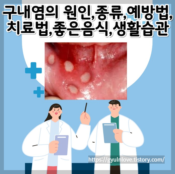 구내염의 원인&#44; 종류 &#44; 구내염예방법&#44; 치료법&#44; 구내염빨리낫는법&#44; 구내염에 좋은음식 안내