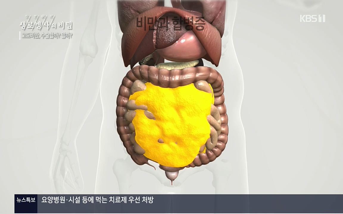 생로병사의 비밀.E828.220728p.H264-F1RST.mp4_20220728_204802.739.jpg