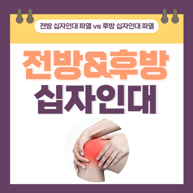  전방 십자인대 파열과 후방 십자인대 파열의 원인/진단/수술/예후