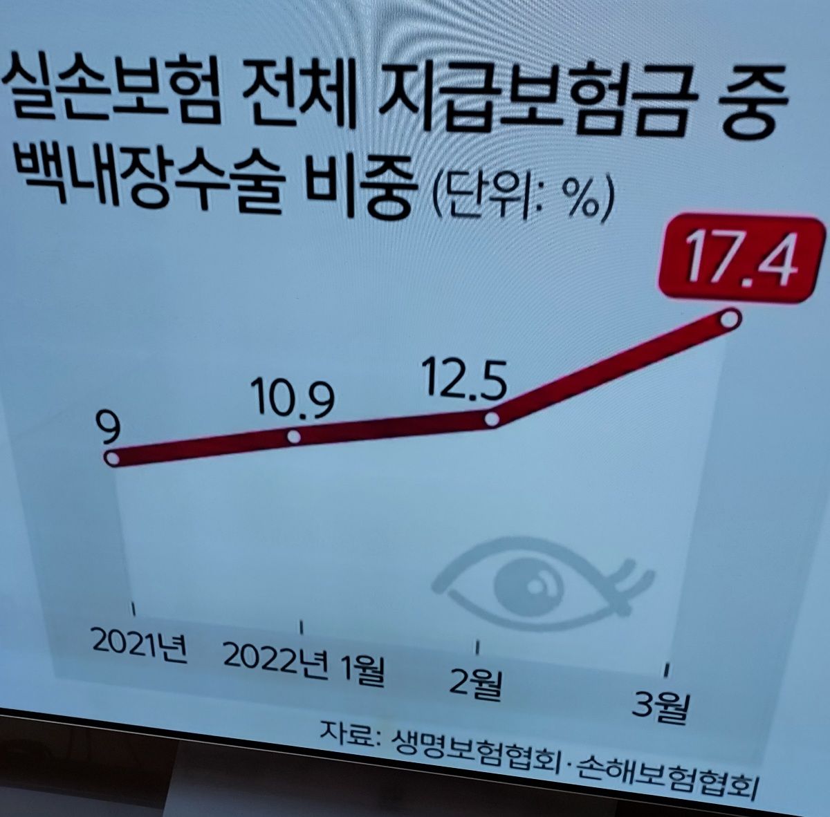 실손 백내장